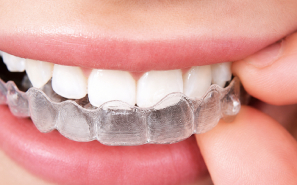 Dental mouthguard