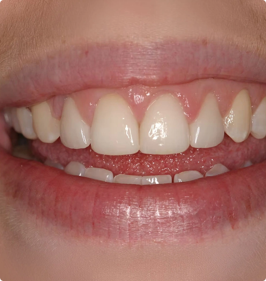 Picture teeth person