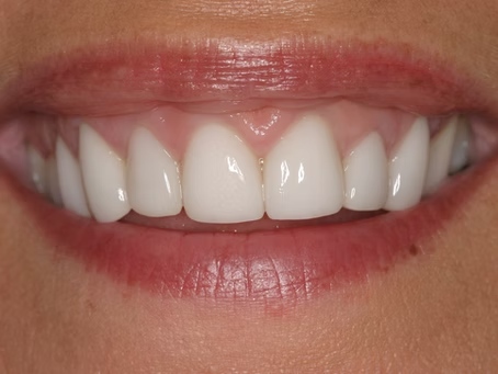 Picture woman smiling