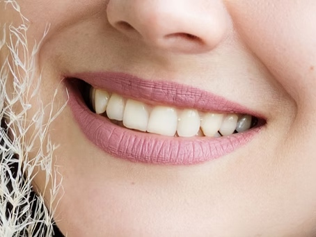Woman smiling dental clinic graystone
